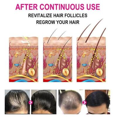Nourishing Anti- Greying Hair Serum for All Hair Types – 30ml