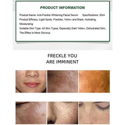 Beauty Anti Freckle Face Serum 30ml