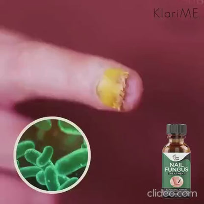Fast Nail Fungal Treatments Nail Repair