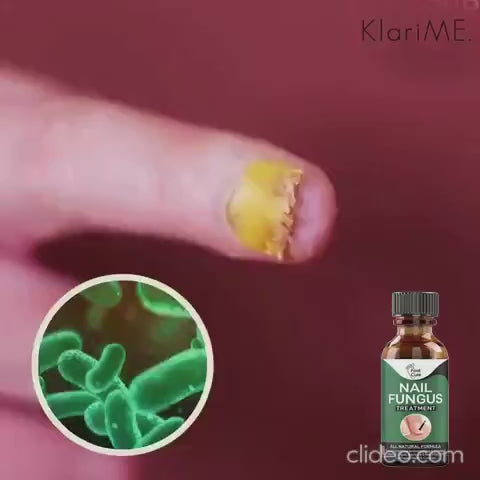 Fast Nail Fungal Treatments Nail Repair